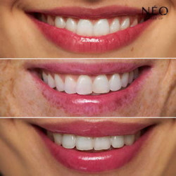 Lip Oil pH Reagente